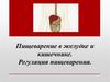 Пищеварение в желудке и кишечнике. Регуляция пищеварения