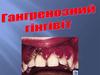 Гангренозний гінгівіт