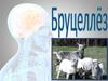 Бруцеллёз - зоонозное инфекционно-аллергическое заболевание