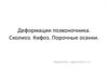 Деформации позвоночника. Сколиоз. Кифоз. Порочные осанки