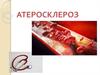 Атеросклероз