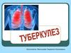 Туберкулез: угроза для всей планеты