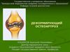 Деформирующий остеоартроз