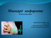 Миокард инфаркты