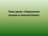 Нарушение осанки и плоскостопие
