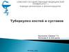 Туберкулез костей и суставов