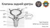 Клапаны задней уретры