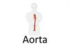 Aorta. The walls of the arteries