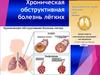 Хроническая обструктивная болезнь лёгких