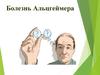 Болезнь Альцгеймера