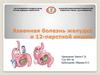 Язвенная болезнь желудка и 12-перстной кишки