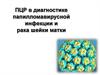 ПЦР в диагностике папилломавирусной инфекции и рака шейки матки