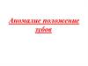 Аномалии положения зубов