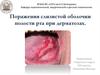 Поражения слизистой оболочки полости рта при дерматозах