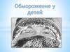 Обморожение у детей