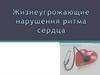 Жизнеугрожающие нарушения ритма сердца