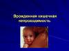 Врожденная кишечная непроходимость
