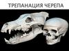 Трепанация черепа