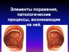 Элементы поражения, патологические процессы, возникающие на ней