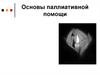 Паллиативная помощь
