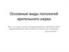 Основные виды патологий зрительного нерва