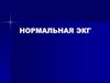 Нормальная ЭКГ