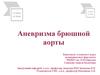 Аневризма брюшной аорты