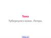 Туберкулёз кожи. Лепра
