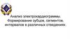Анализ электрокардиограммы. Формирование зубцов, сегментов, интервалов в различных отведениях