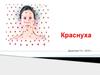 Краснуха